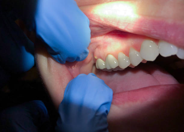 Best Emergency Care for Gum Disease in Lincroft, NJ